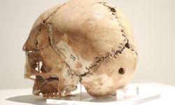 Dünyanın ilk beyin ameliyatına ait kafatası Aksaray'da