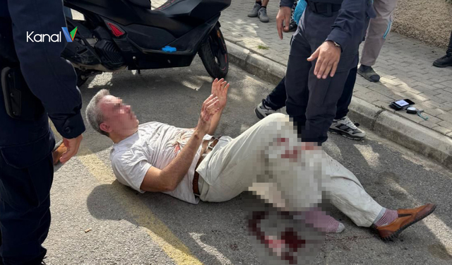 Alanya’da Boşanma Aşamasındaki Eşini Bıçakladı