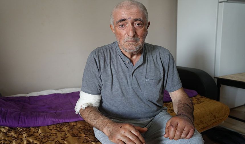 Eşi tarafından defalarca bıçaklandı